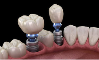 McClane Dentistry Stuart Florida - 4