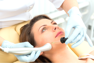 Microdermabrasion near me - 2
