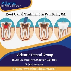 Root Canal Treatment in Whittier, CA