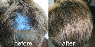 Most Natural-Looking the Best Mens Hair Systems - 3