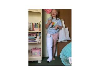 Best Compression Bandages for Lymphedema - 2